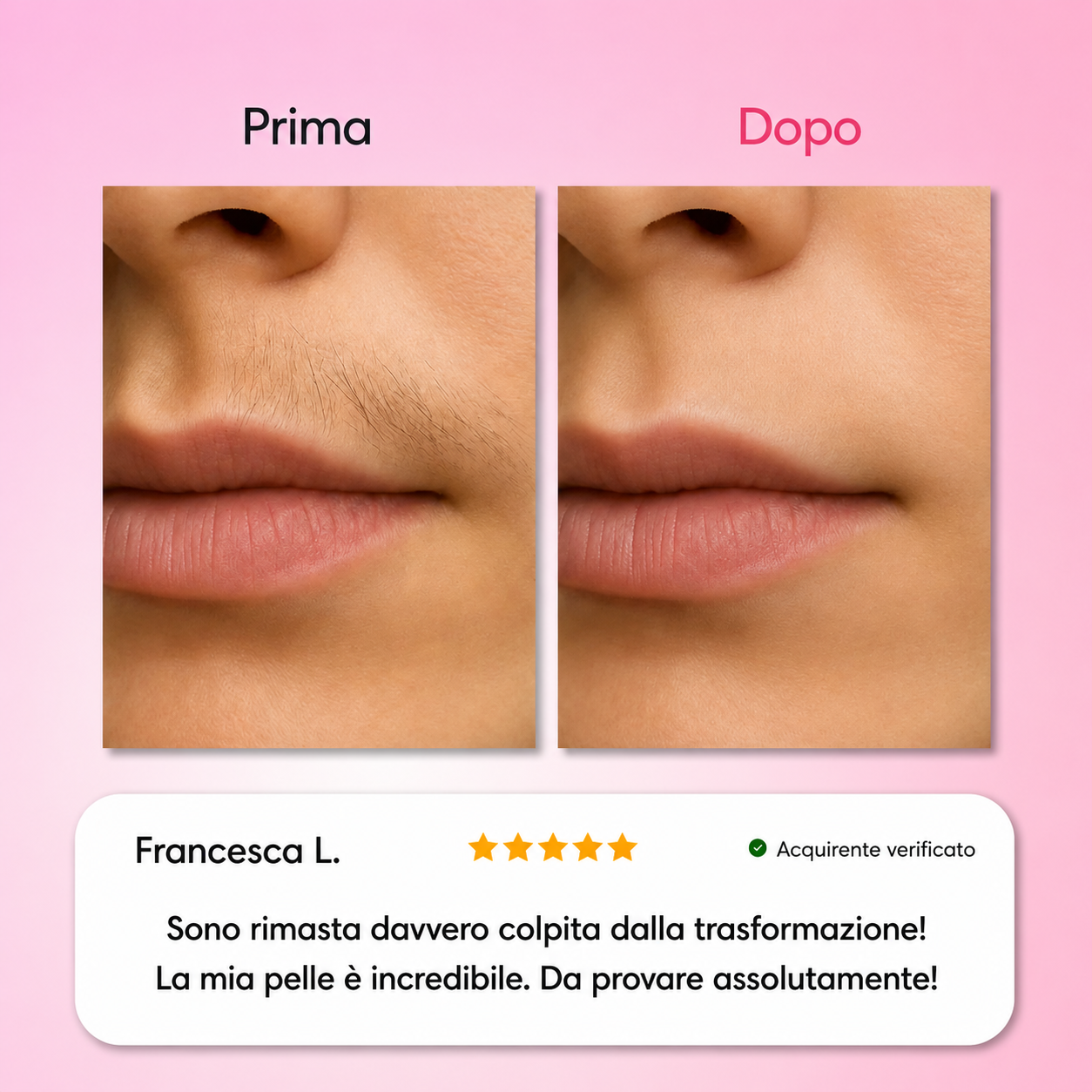 Dermelia - Kit Trilogy per la depilazione