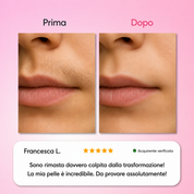 Dermelia - Kit Trilogy per la depilazione