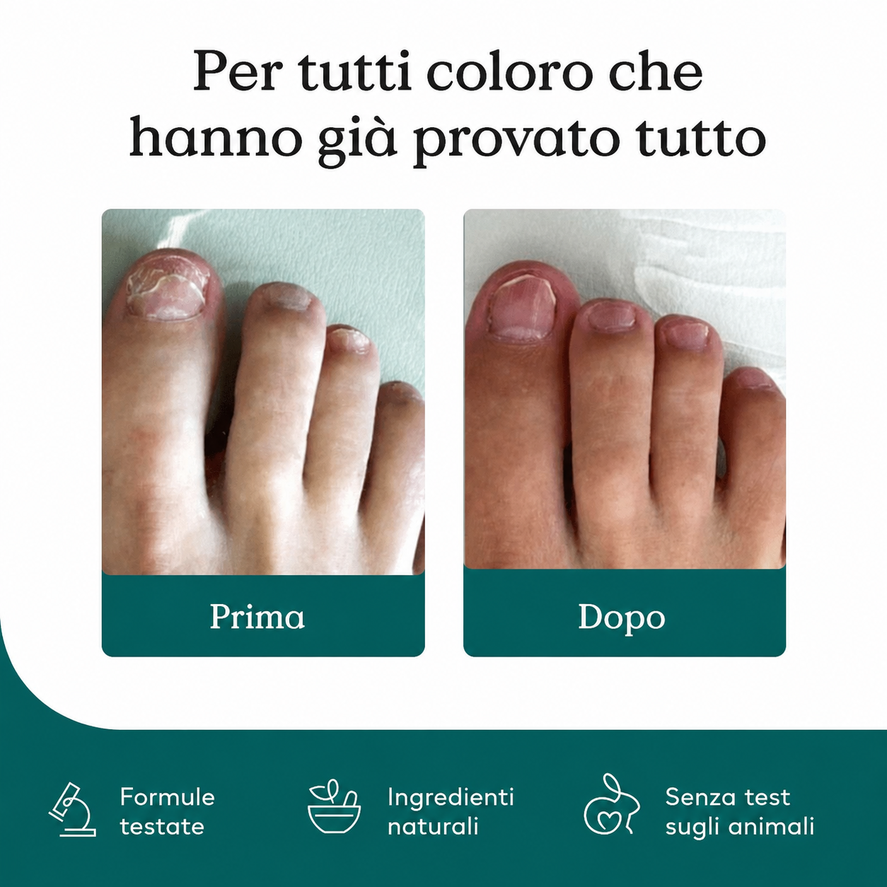 Penna per la cura delle unghie con tecnologia Nail Matrix® contro i fastidiosi funghi delle unghie