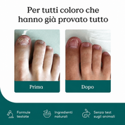 Penna per la cura delle unghie con tecnologia Nail Matrix® contro i fastidiosi funghi delle unghie