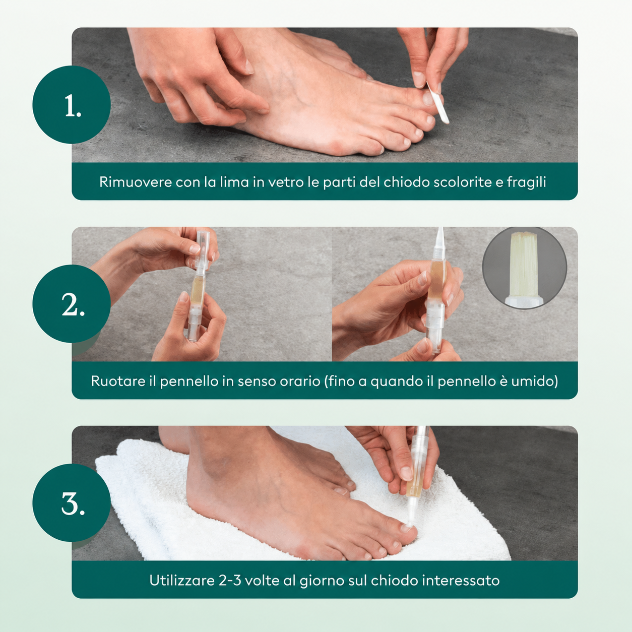 Penna per la cura delle unghie con tecnologia Nail Matrix® contro i fastidiosi funghi delle unghie