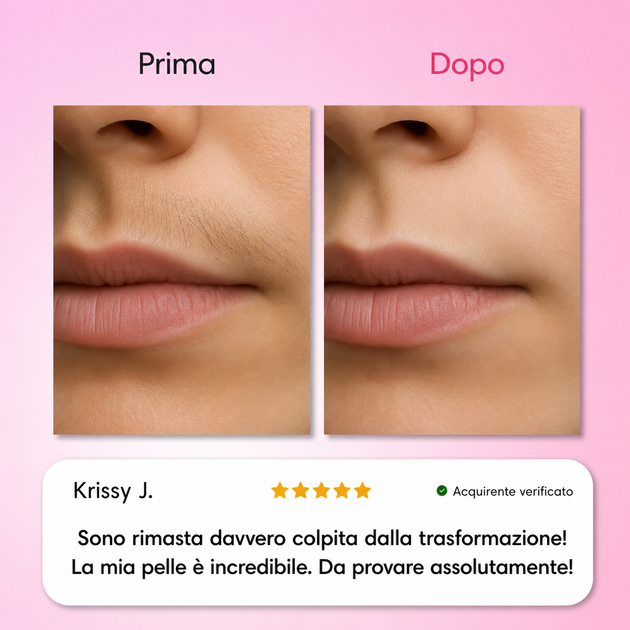 Dermelia - Kit trilogia per la depilazione