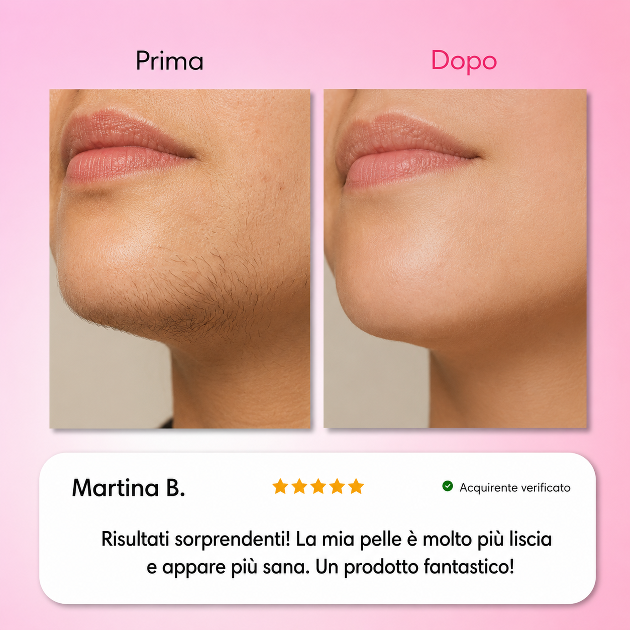 Dermelia - Kit Trilogy per la depilazione