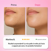 Dermelia - Kit Trilogy per la depilazione